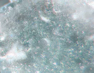 Hyaluronic acid