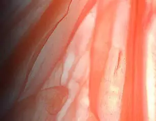 Myrixin Ingredient Image