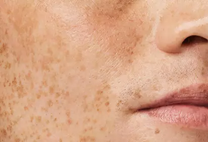 Comment exfolier sans perturber votre barriere cutanee
