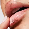 Lip Care