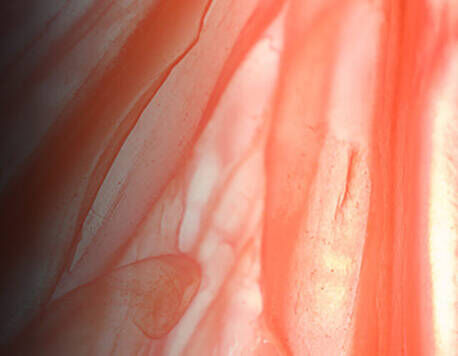 Endophytol Image