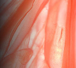 Endophytol Image