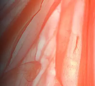 Endophytol Image