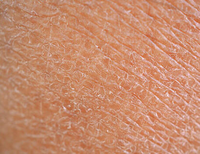 What Causes Fine Lines + Wrinkles Image