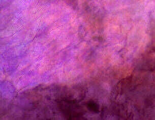 1.3% Hyaluronic Acid