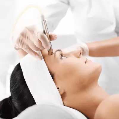 IPL Laser