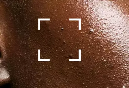 Soins Professionnels et Traitements pour les Peaux Foncees