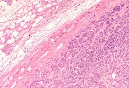 Types of Wrinkles and How to Treat Them