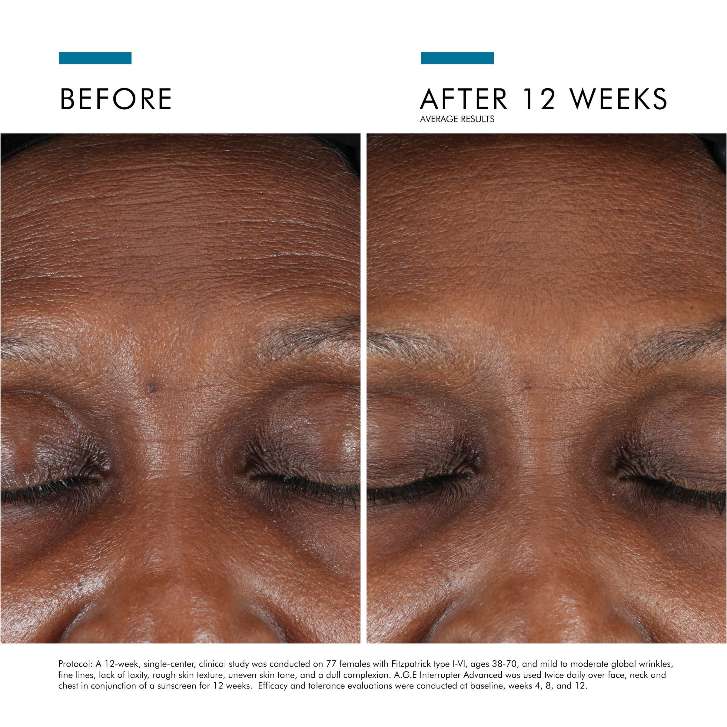 A.G.E. Interrupter Advanced Anti-Wrinkle Face Cream | SkinCeuticals