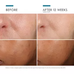 Phloretin CF® with Ferulic Acid