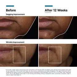 AGE Interrupter Ultra Serum