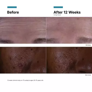 C E Ferulic with 15% l-ascorbic acid