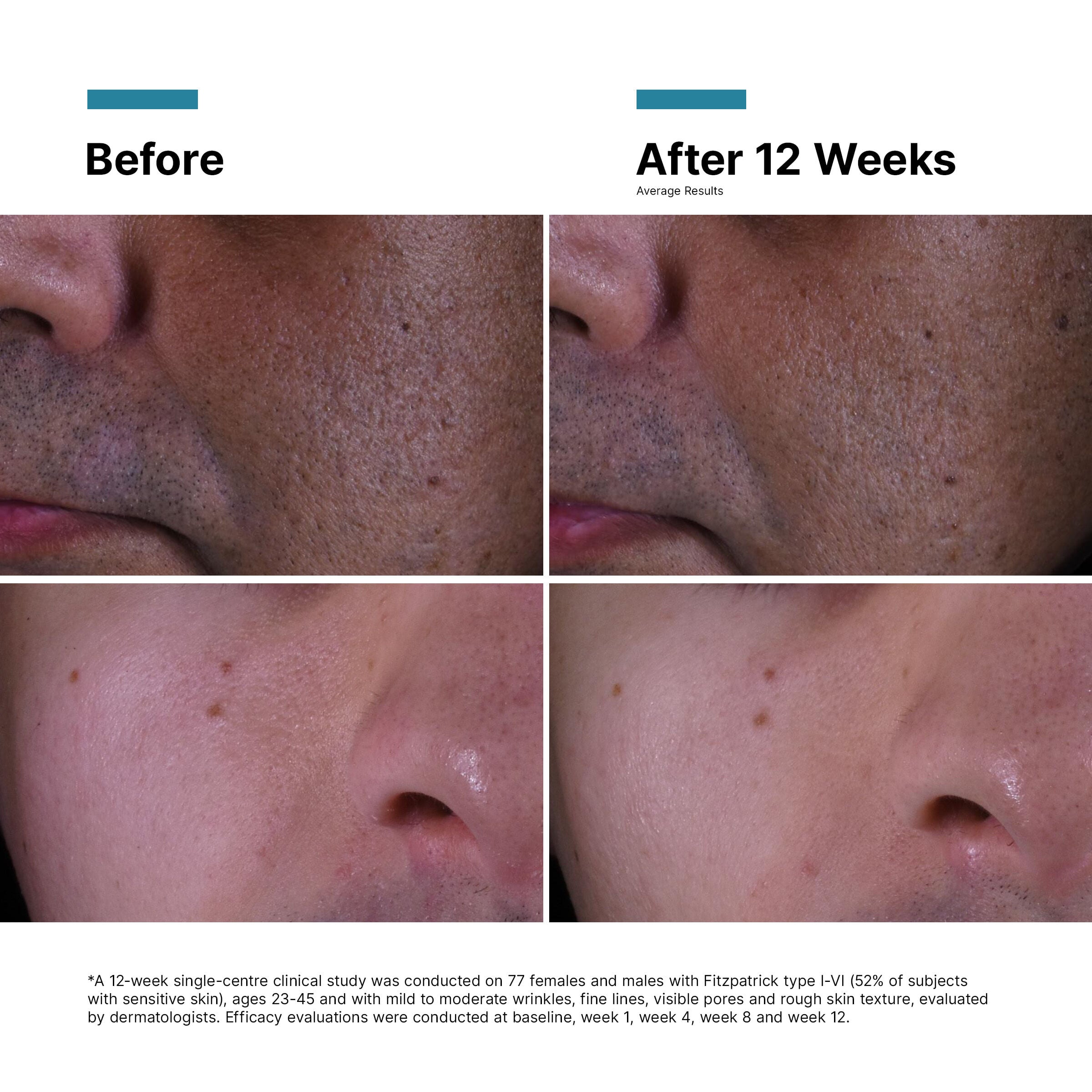 P-TIOX Anti-Wrinkle Cream