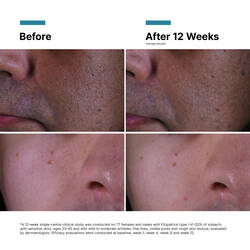 P-TIOX Anti-Wrinkle Cream