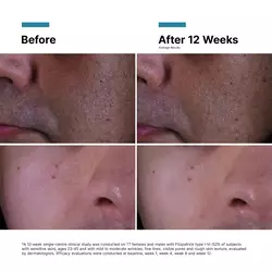 P-TIOX Anti-Wrinkle Cream for Glass Skin Radiance