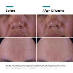 P-TIOX Anti-Wrinkle Cream