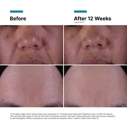P-TIOX Anti-Wrinkle Cream for Glass Skin Radiance