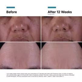 P-TIOX Anti-Wrinkle Cream