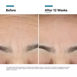 Advanced RGN-6 Face Cream
