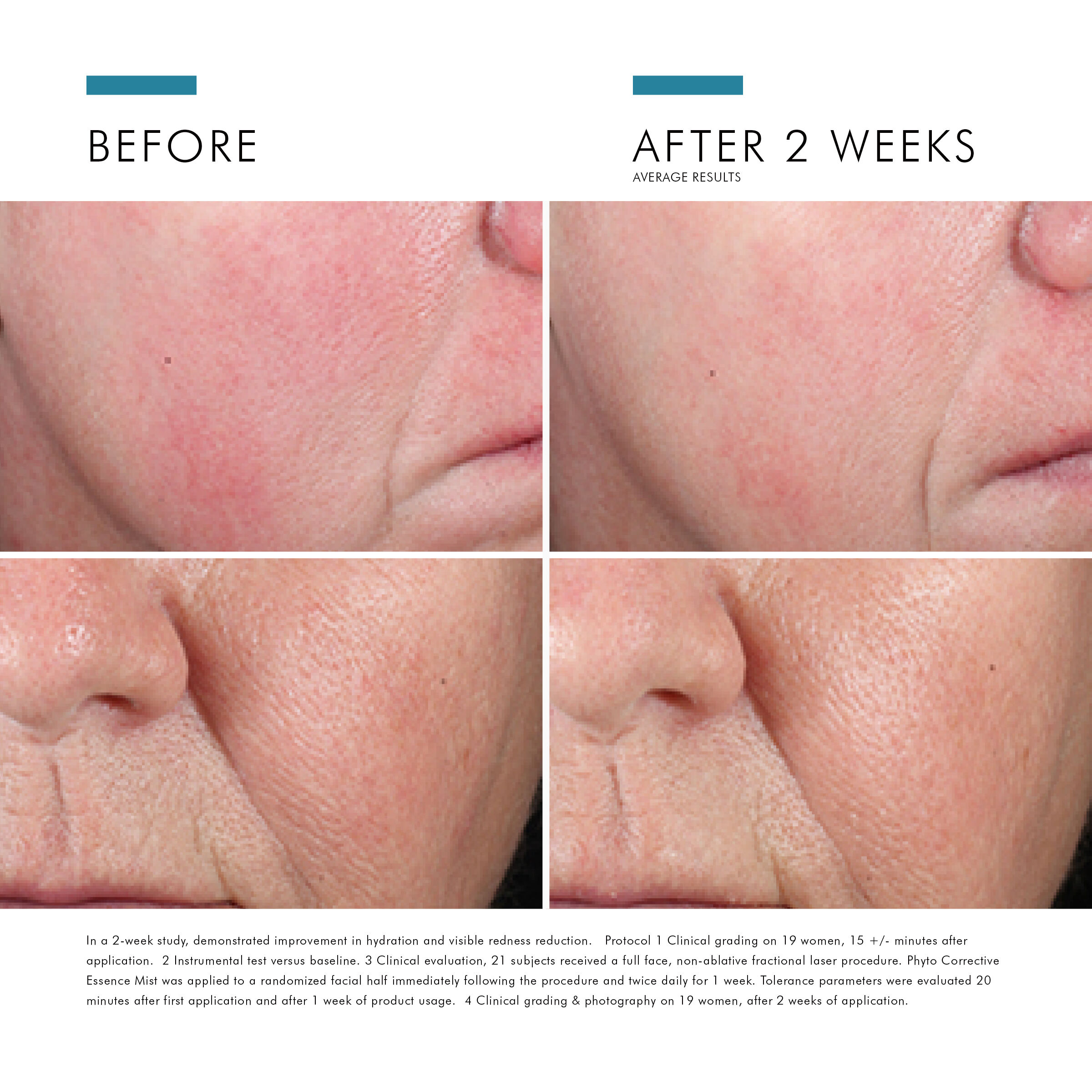 Phyto Corrective Essence Mist