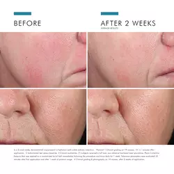 Phyto Corrective Essence Mist