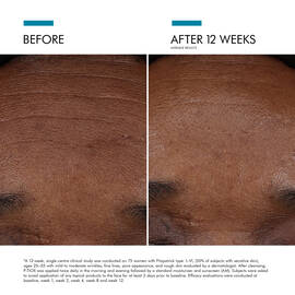 Visible results after 12 weeks