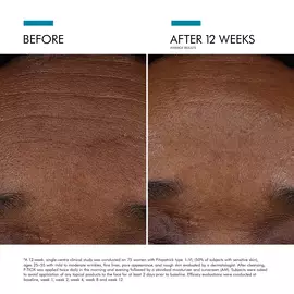 Visible results after 12 weeks