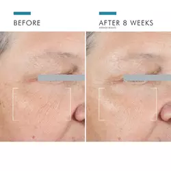A.G.E. Advanced Eye Cream Dark Circles and Wrinkles