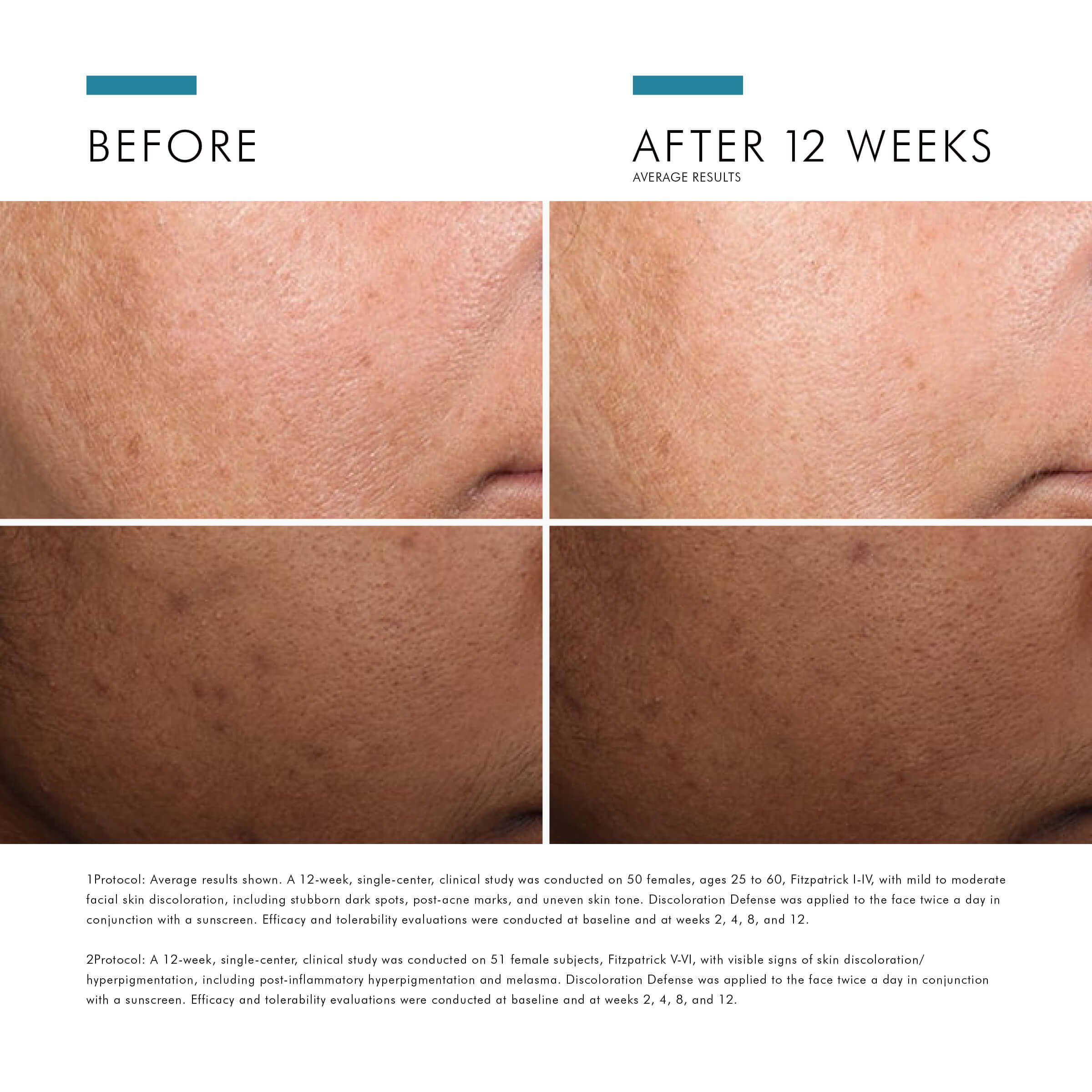 Discoloration Defense - Discoloration Serum - SkinCeuticals