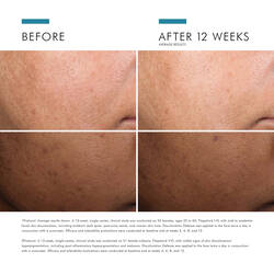 Discoloration Defense