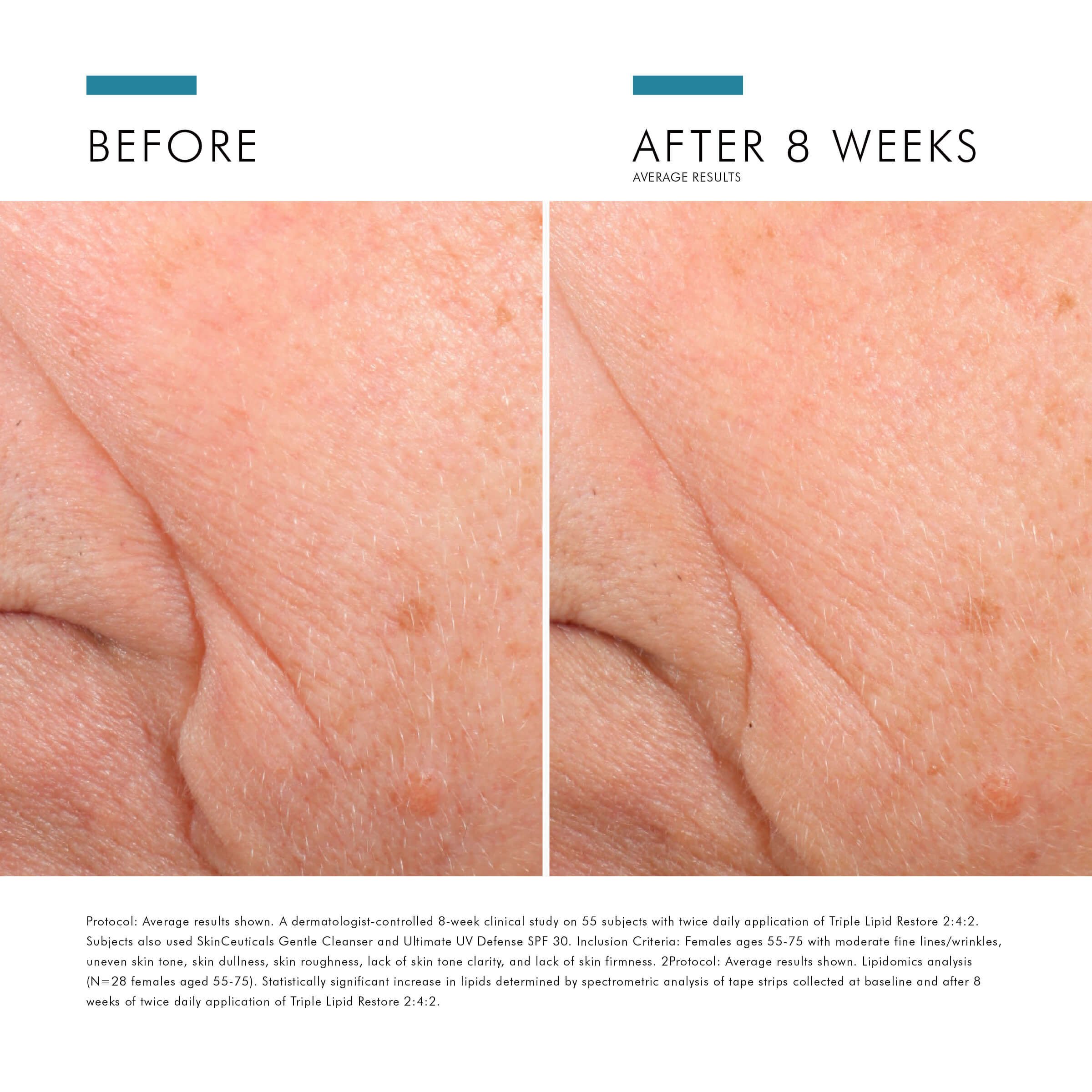 専用:スキンシューティカルズ triple lipid restore 48ml SkinCeuticals Triple Lipid Restore – JoyVIVA