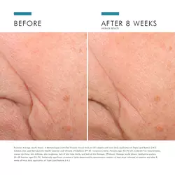 Triple Lipid Restore 2:4:2 Face Cream
