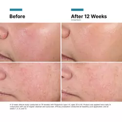 Advanced RGN-6 Face Cream