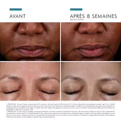 Cell Cycle Catalyst Serum Exfoliant Anti-Age