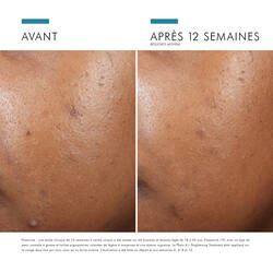 Phyto A+ Brightening Treatment