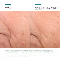 Triple Lipid Restore 2:4:2 Creme pour le visage