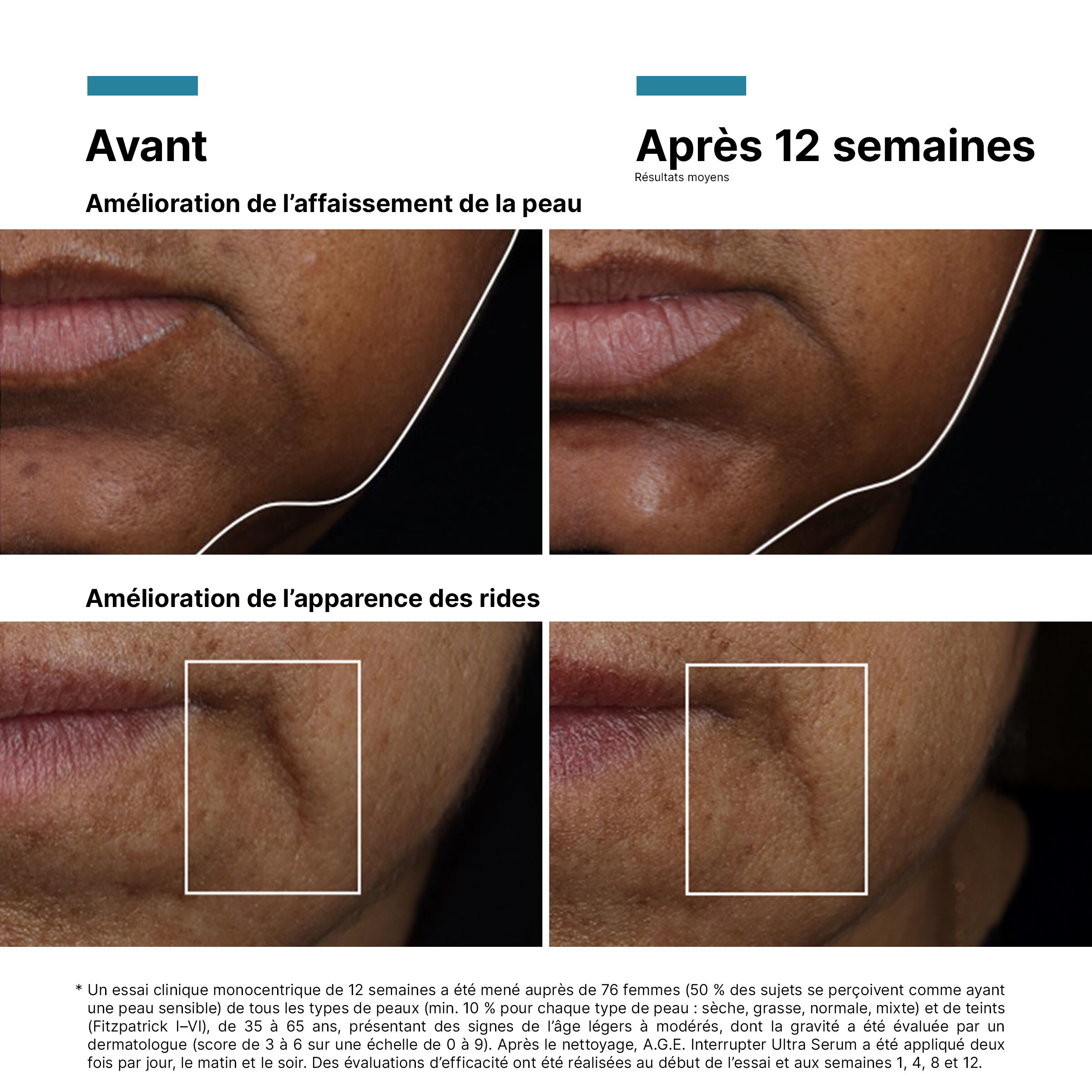 AGE Interrupter Ultra Serum