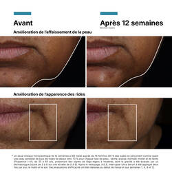 AGE Interrupter Ultra Serum