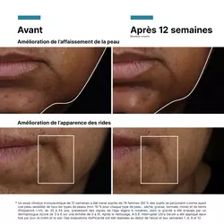 AGE Interrupter Ultra Serum