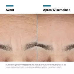 Advanced RGN-6 Creme pour le visage