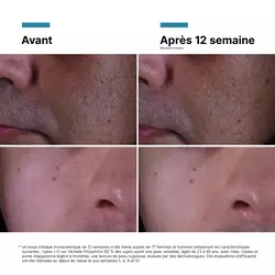 Creme P-TIOX anti-rides pour un eclat Glass Skin