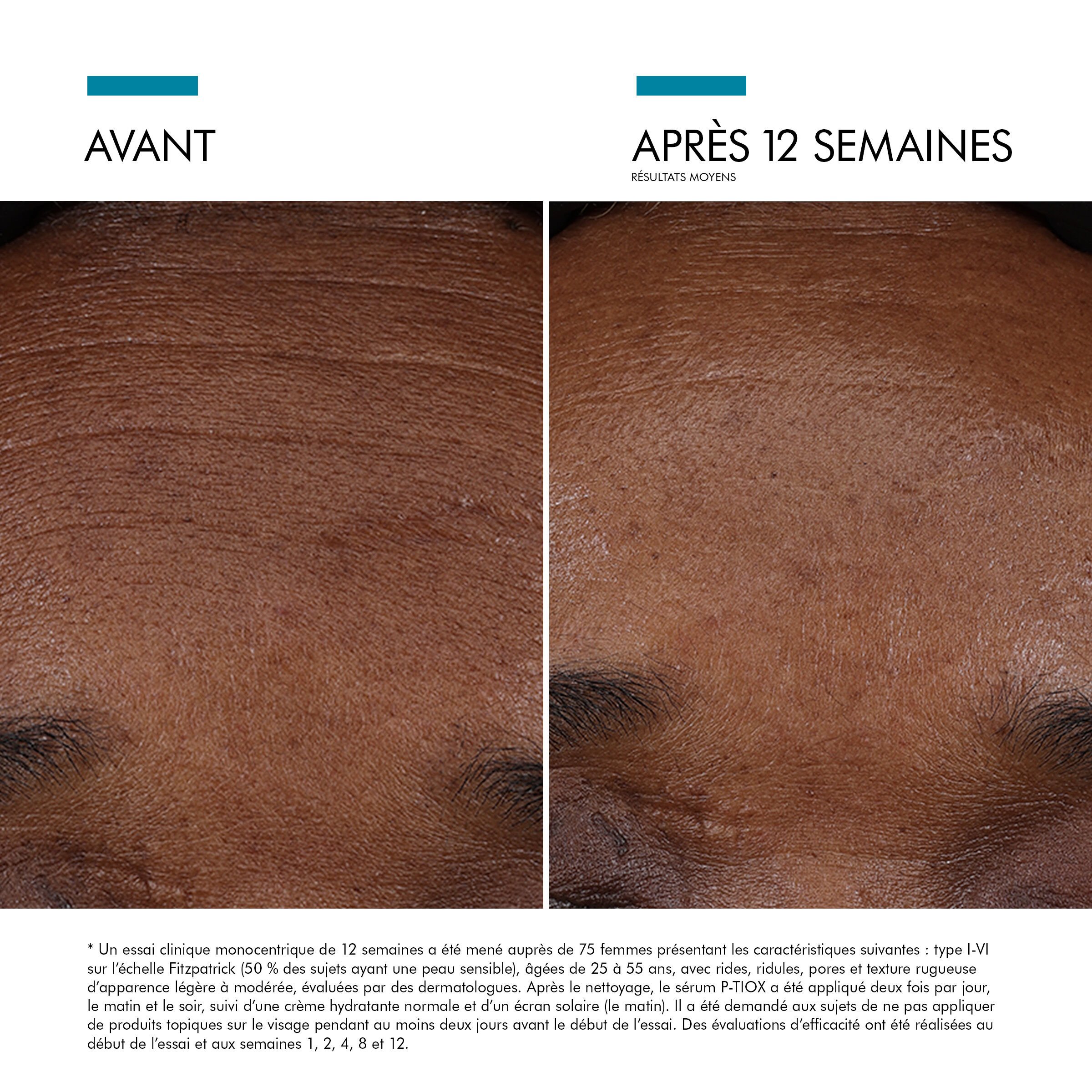 Visible results after 12 weeks