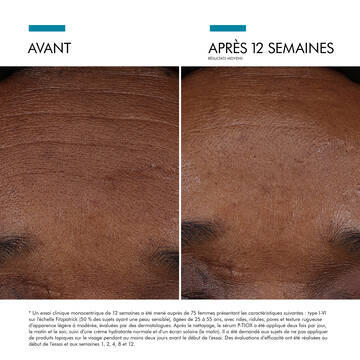 Visible results after 12 weeks