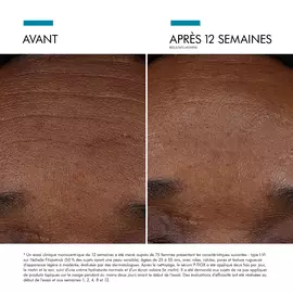 Visible results after 12 weeks