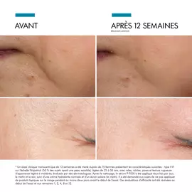 Proven efficiency on finelines and wrinkles after 12 weeks