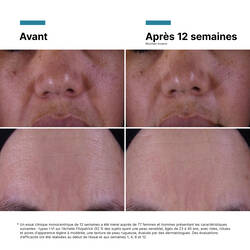 Creme P-TIOX Anti-Rides
