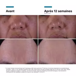 Creme P-TIOX anti-rides pour un eclat Glass Skin