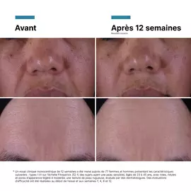 Creme P-TIOX Anti-Rides