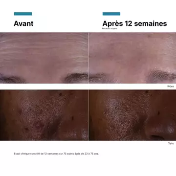 C E Ferulic avec 15 % d’acide l-ascorbique