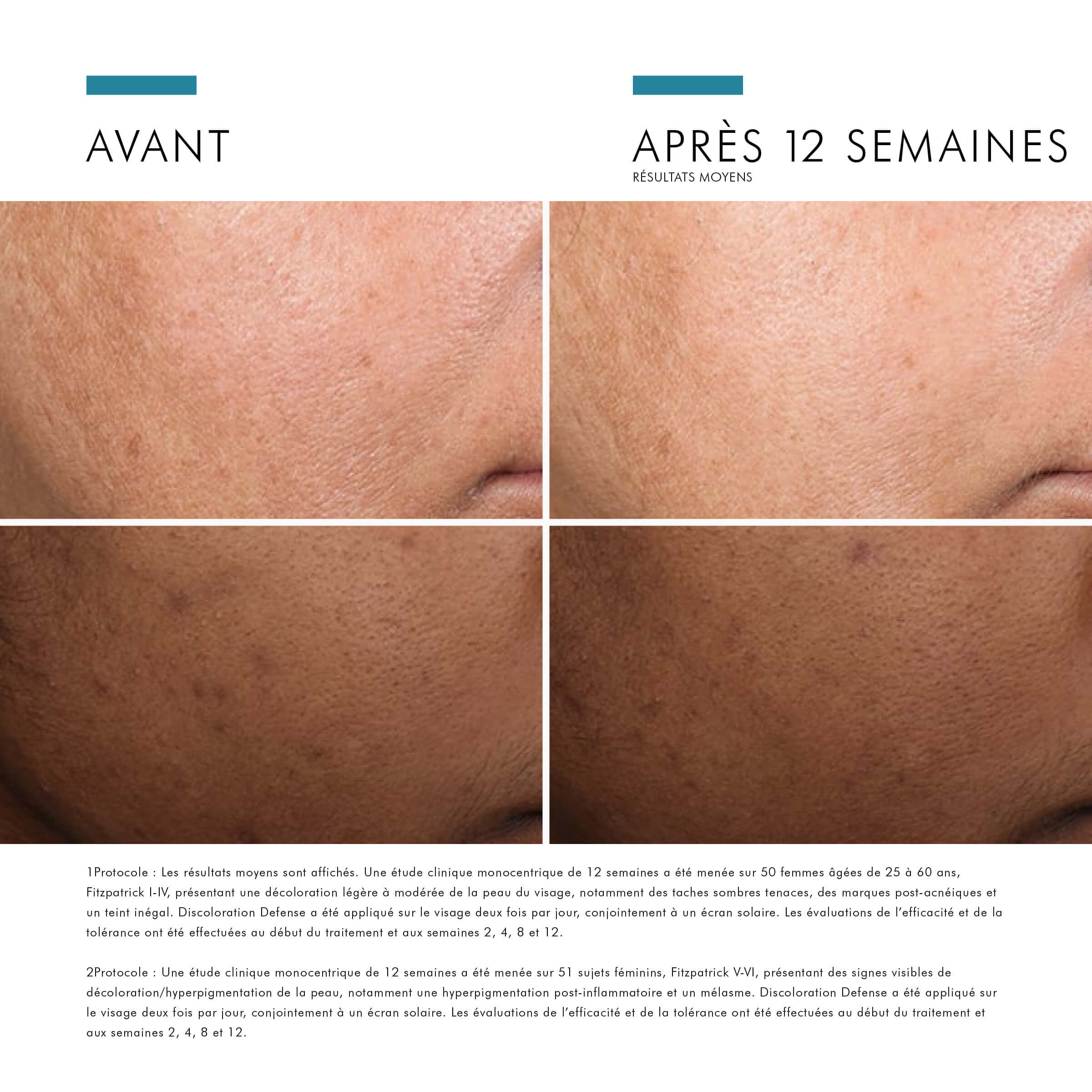 Discoloration Defense